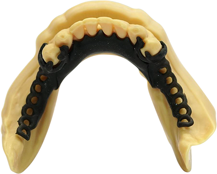 Dental-model-with-denture-base-447px